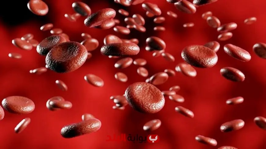 ١٤ سببًا خطيرًا لأعراض الأنيميا التي حذر منها حسام موافي