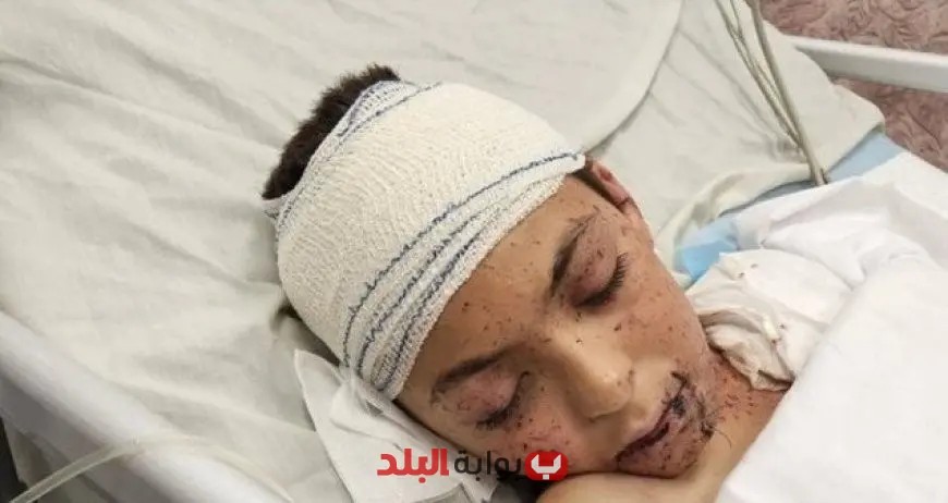 إيطاليا تستعد لاستقبال طفل فلسطيني ناجٍ من القصف الإسرائيلي الأسبوع المقبل