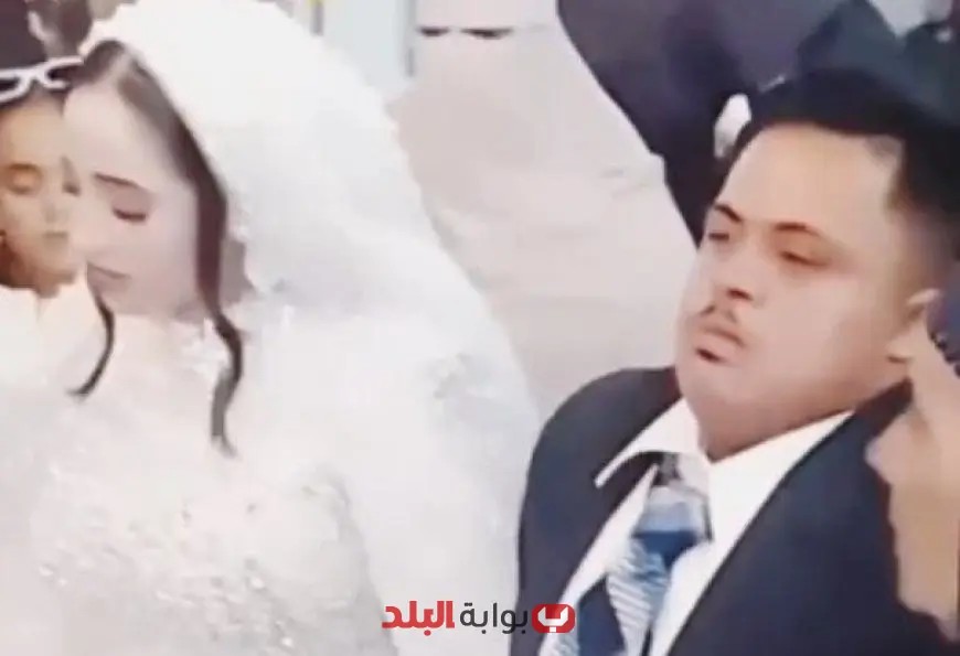 “خبراء يوضحون: متى يُسمح بالزواج لذوي الإعاقة الذهنية؟ اكتشف الشروط الآن!”