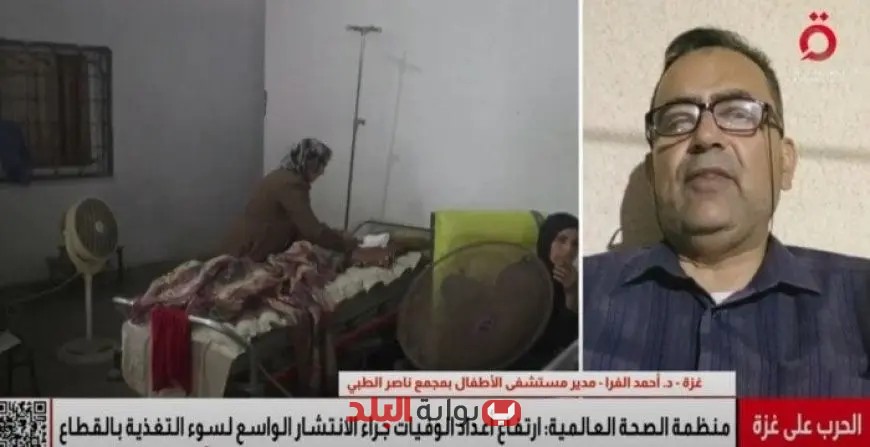 مدير مستشفى الأطفال بمجمع ناصر الطبي يحذر من أزمة سوء التغذية المتفاقمة التي تهدد أطفال غزة بسبب نقص الغذاء والدواء