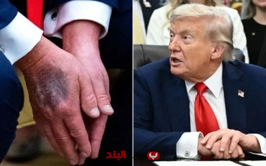 أول رد أمريكي على شائعة وفاة ترامب بعد اختفائه عن الإعلام
