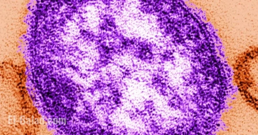 Tragic Measles Outbreak Claims Life of Alberta Infant