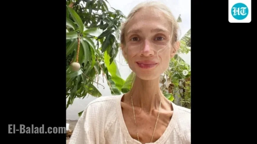27-Year-Old Woman Dies in Bali After Adopting Fruitarian Diet