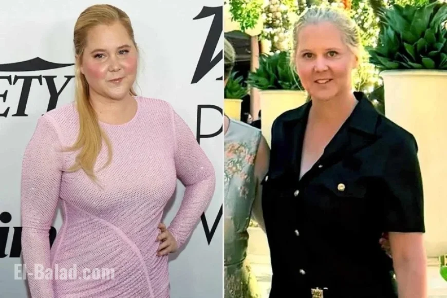 Amy Schumer Flaunts Remarkable Weight Loss in New Photo: ‘Legs for Days’